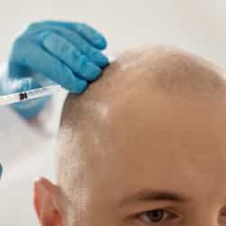 Best Countries for Hair Transplant Surgery in 2024